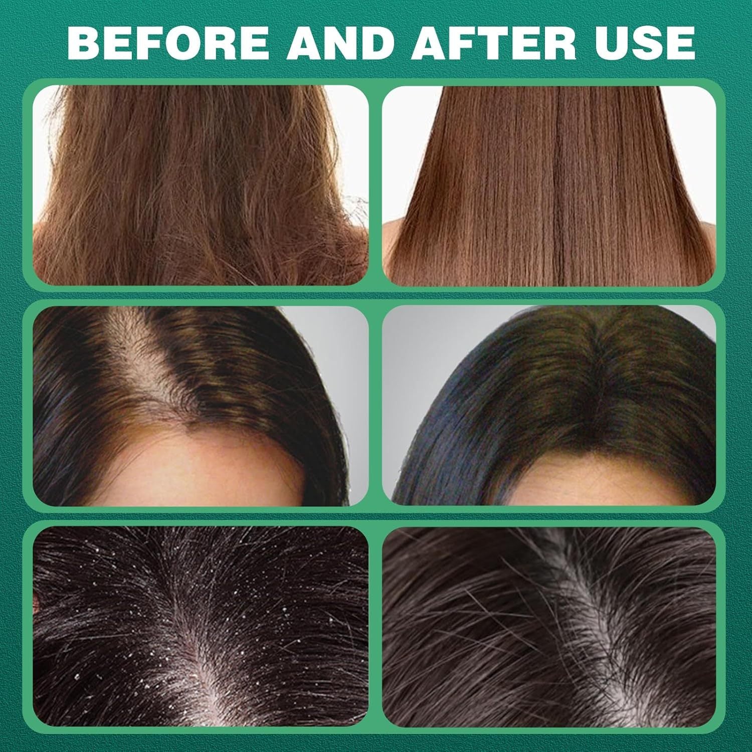 cypress Leaf HairGrowth Soap
